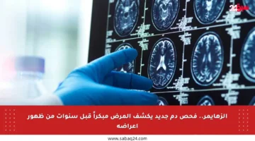 الزهايمر.. فحص دم جديد يكشف المرض مبكراً قبل سنوات من ظهور أعراضه